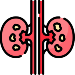 Kidney Stones