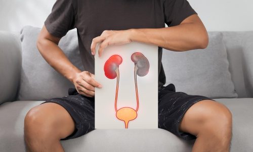 Male Urethral Stricture Disease